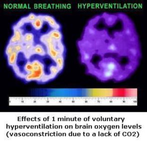 vo2t-hypervent