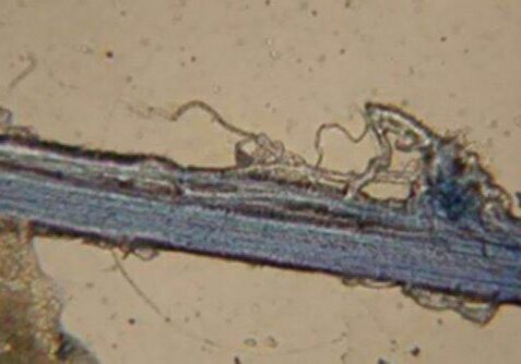 blog-microscopy-and-bonghan-vessel_800x535