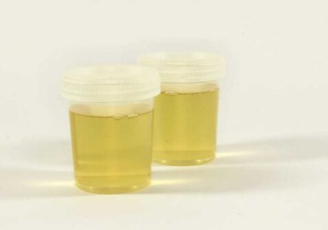 blog-urine-therapy